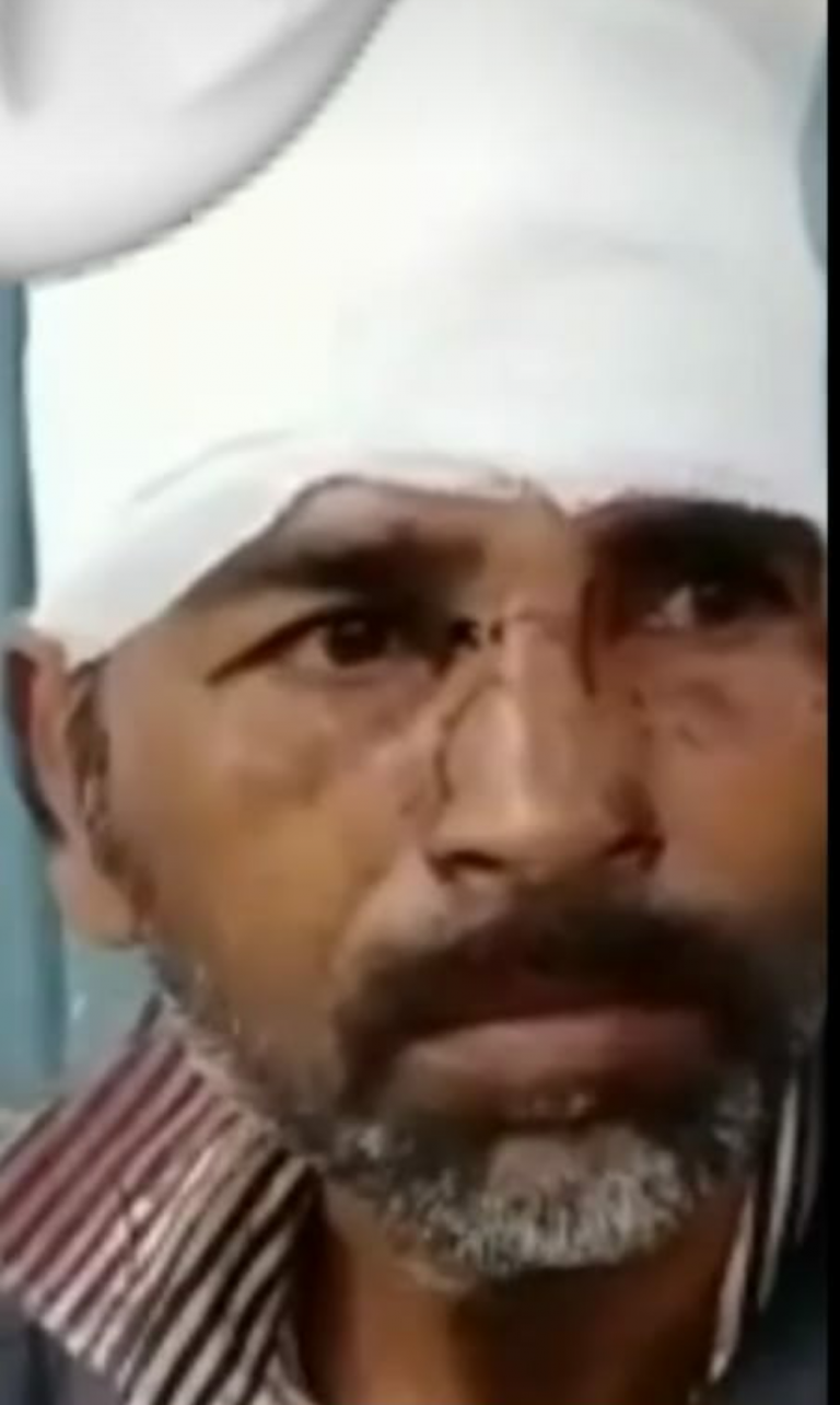 पत्नी घर बैठ कर पी रही थी शराब, पति ने टोका तो सरिए से सिर फोड़ डाला, पति भी है शराबी