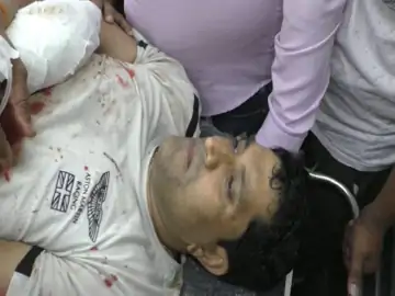 जिम से बाहर निकलते ही व्यवसायी पर लाठियों से हमला, फिर मारी गोलियां