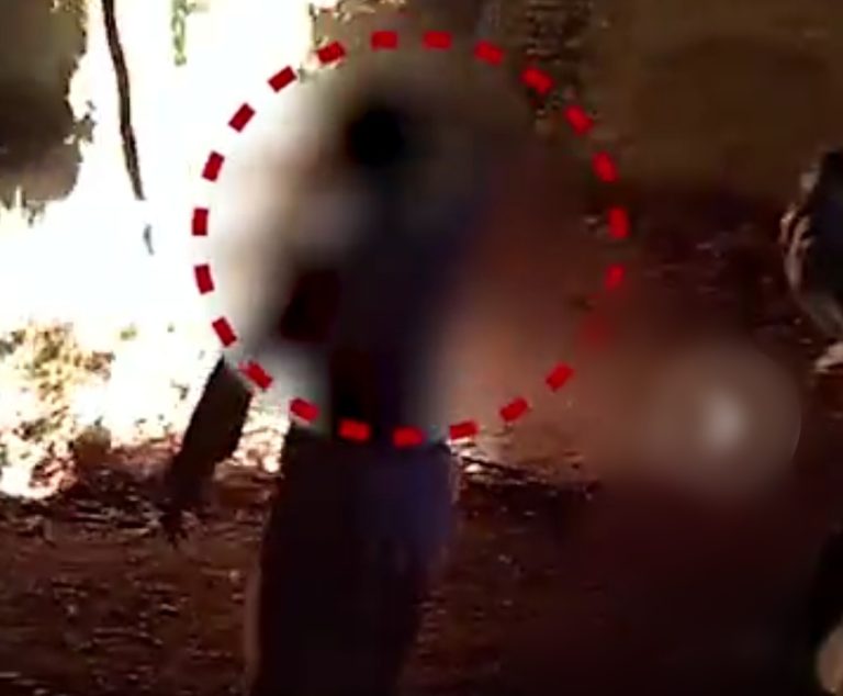 होलिका की आग में गिरा व्यक्ति, हालत गम्भीर