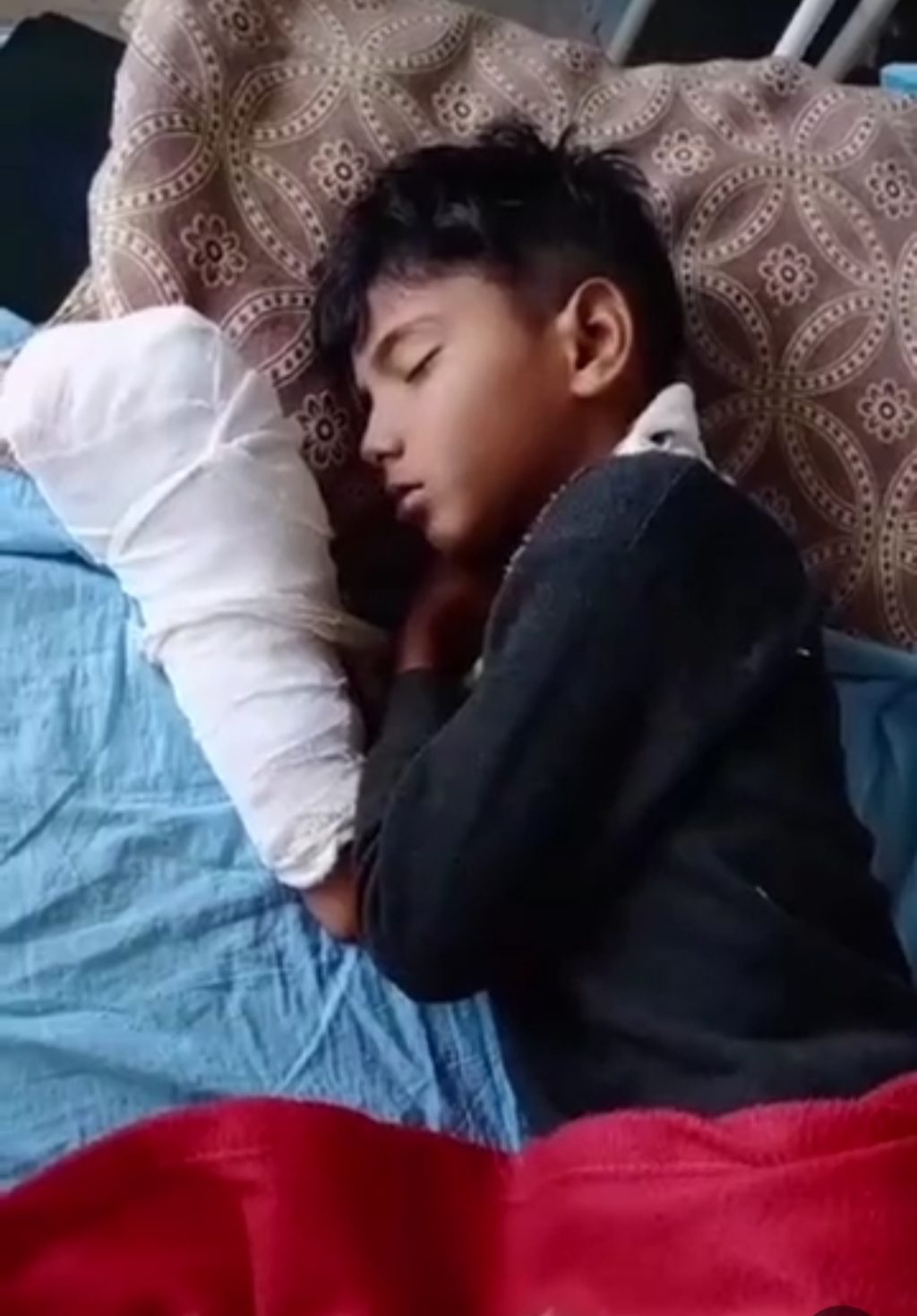 10 साल के बच्चे के हाथ में फट गया सूतली बम, सीधे हाथ की दो उंगलियां उखड़ कर अलग हो गईं