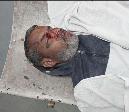 बूंदी में स्कॉर्पियो की भीषण टक्कर से युवक की मौत,  दुकान पर जाते समय हुआ ​हादसा, आरोपी ड्राइवर गाड़ी सहित फरार