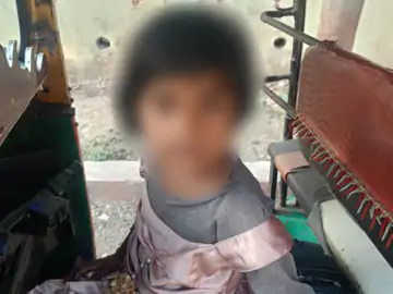 कोचिंग जाने से नाराज शिक्षक ने बच्ची से की पिटाई, हाथ फ्रेक्चर, पिता का आरोप- बच्चों को गालियां देता है, आरोपी निलम्बित और जालोर स्थानांतरण