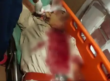 बिजली चोरी रोकने गई विजिलेंस टीम को बंधक बनाकर पीटा, एक कर्मचारी पर दराती से वार किया, गार्ड के सिर पर आए नौ टांके, जयपुर रेफर