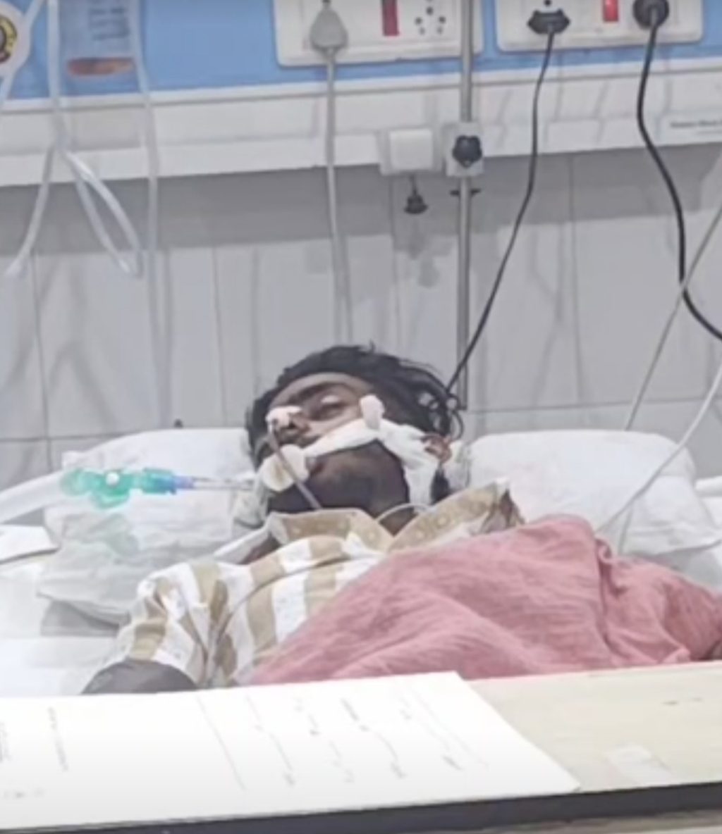 पुलिस कस्टडी में युवक की हालत बिगड़ी, 3 दिन से बेहोश, डॉक्टर ने बताया-सीने पर चोट और दिमागी बुखार