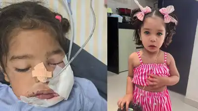 3 साल की मासूम ने टॉफी समझकर विस्फोटक चबाया, जबड़ा फटा, गांव में मचा हड़कम्प